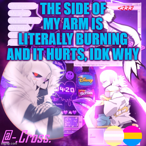 Ahhhhhhh | THE SIDE OF MY ARM IS LITERALLY BURNING AND IT HURTS, IDK WHY | image tagged in chocos cross temp | made w/ Imgflip meme maker