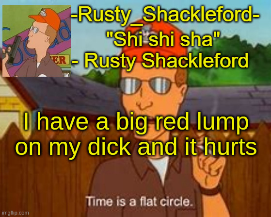 -Rusty_Shackleford- | I have a big red lump on my dick and it hurts | image tagged in -rusty_shackleford- | made w/ Imgflip meme maker