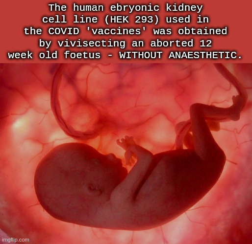 HEK 293 human embryonic kidney cell line | The human ebryonic kidney cell line (HEK 293) used in the COVID 'vaccines' was obtained by vivisecting an aborted 12 week old foetus - WITHOUT ANAESTHETIC. | image tagged in fetus | made w/ Imgflip meme maker