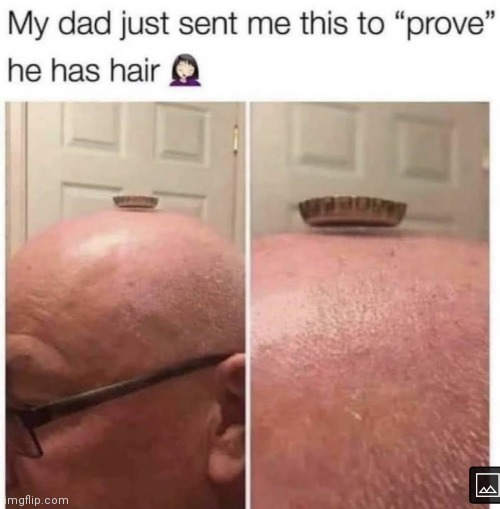 you will always be bald | image tagged in memes,hair,bald | made w/ Imgflip meme maker