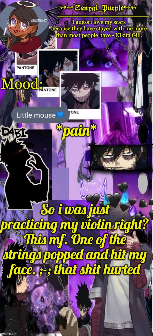 Dabi Temp :D | *pain*; So i was just practicing my violin right? This mf. One of the strings popped and hit my face. ;-; that shit hurted | image tagged in dabi temp d | made w/ Imgflip meme maker