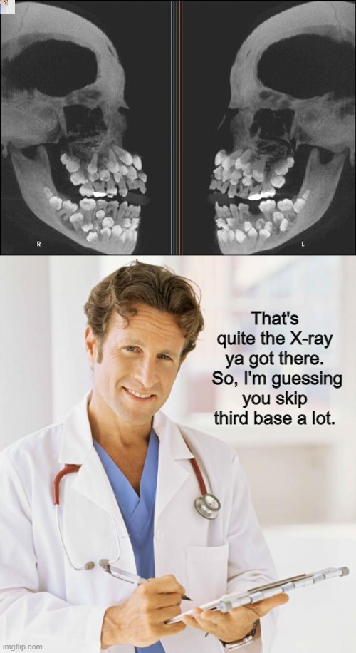 That's quite the X-ray ya got there.  So, I'm guessing you skip third base a lot. | image tagged in doctor | made w/ Imgflip meme maker