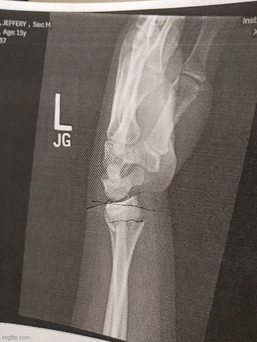 the horizontal line is how its supposed to be. the diagonal one is how it is. | made w/ Imgflip meme maker