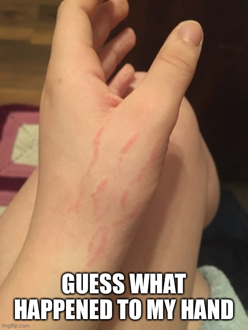 GUESS WHAT HAPPENED TO MY HAND | made w/ Imgflip meme maker