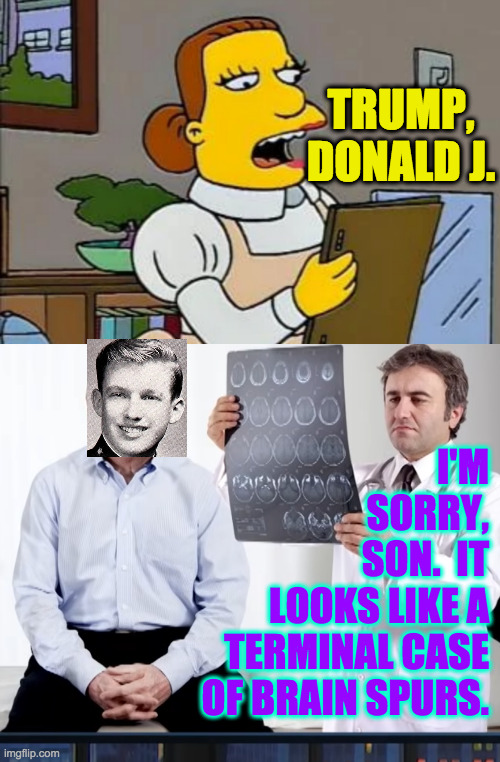 And he's been on life support ever since. | TRUMP, DONALD J. I'M
SORRY,
SON.  IT
LOOKS LIKE A
TERMINAL CASE
OF BRAIN SPURS. | image tagged in diagnoses,memes,brain spurs,trump,lunchlady doris | made w/ Imgflip meme maker