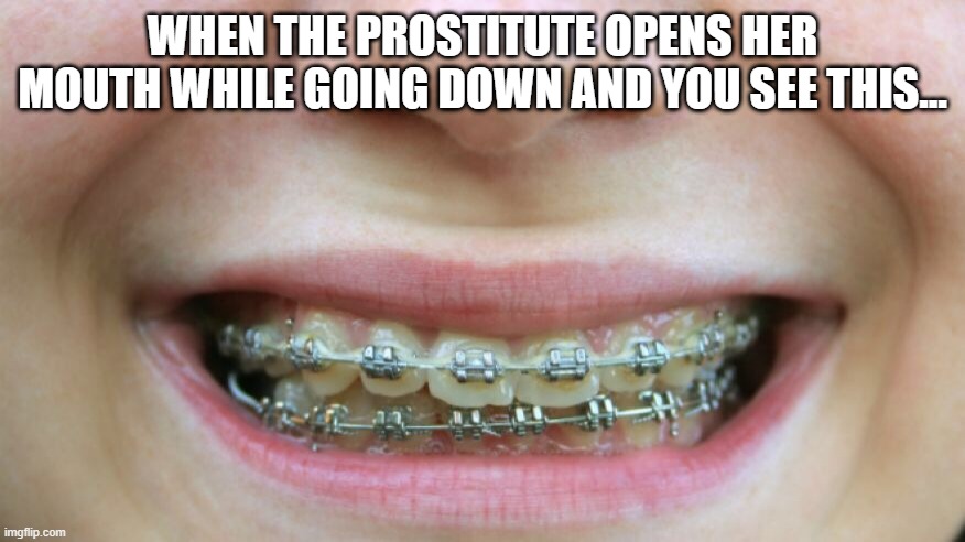 Fear | WHEN THE PROSTITUTE OPENS HER MOUTH WHILE GOING DOWN AND YOU SEE THIS... | image tagged in braces | made w/ Imgflip meme maker