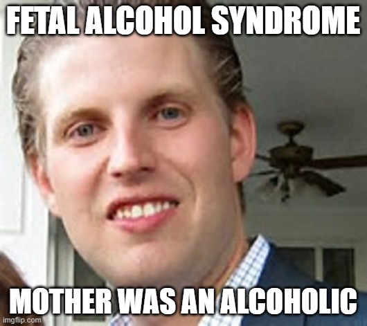 eric trump | FETAL ALCOHOL SYNDROME; MOTHER WAS AN ALCOHOLIC | image tagged in eric trump | made w/ Imgflip meme maker