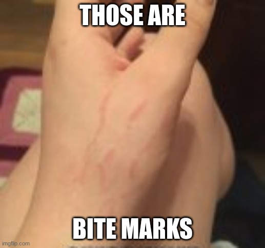 It was bite marks all along | THOSE ARE; BITE MARKS | image tagged in bitemarks | made w/ Imgflip meme maker