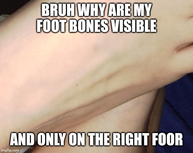 BRUH WHY ARE MY FOOT BONES VISIBLE; AND ONLY ON THE RIGHT FOOR | made w/ Imgflip meme maker