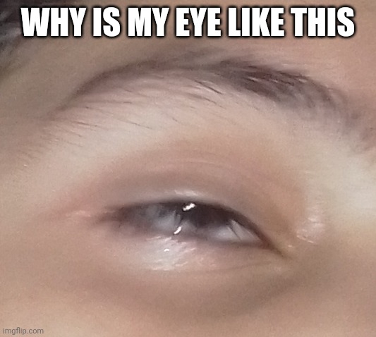 WHY IS MY EYE LIKE THIS | made w/ Imgflip meme maker