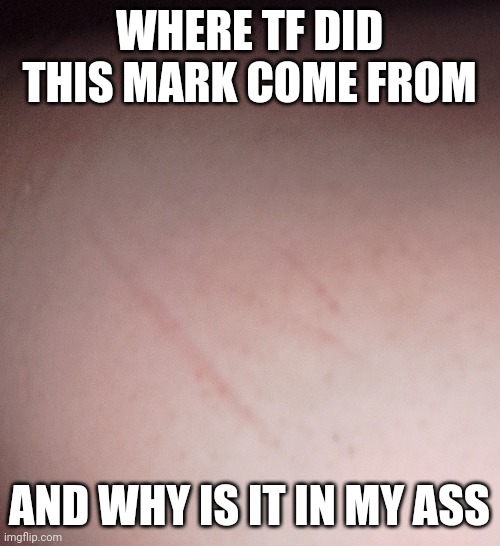 WHERE TF DID THIS MARK COME FROM; AND WHY IS IT IN MY ASS | made w/ Imgflip meme maker