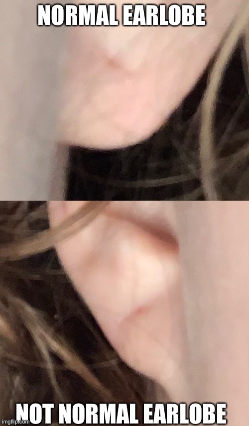 NORMAL EARLOBE NOT NORMAL EARLOBE | made w/ Imgflip meme maker