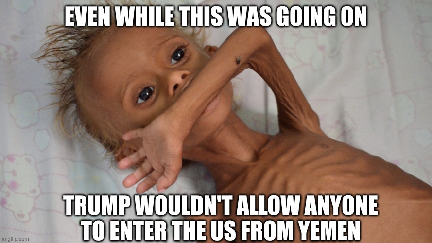 hungry yemen kid | EVEN WHILE THIS WAS GOING ON TRUMP WOULDN'T ALLOW ANYONE TO ENTER THE US FROM YEMEN | image tagged in hungry yemen kid | made w/ Imgflip meme maker
