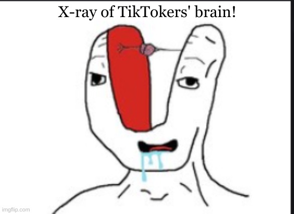 Small brain | X-ray of TikTokers' brain! | image tagged in small brain | made w/ Imgflip meme maker