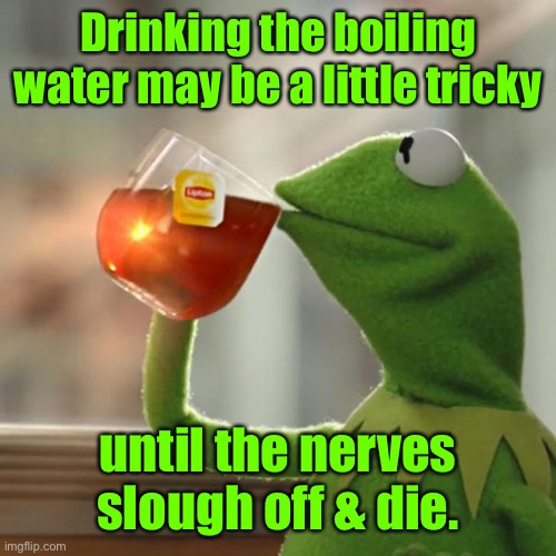 But That's None Of My Business Meme | Drinking the boiling water may be a little tricky until the nerves slough off & die. | image tagged in memes,but that's none of my business,kermit the frog | made w/ Imgflip meme maker