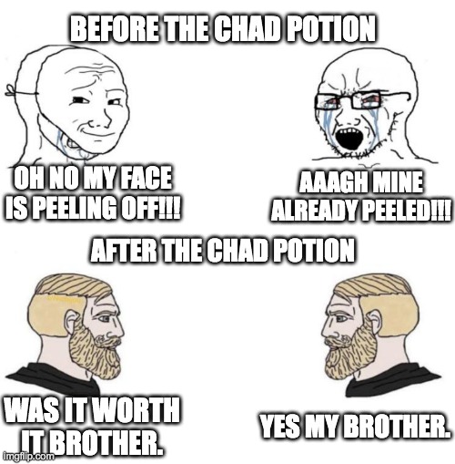 chad potion | BEFORE THE CHAD POTION; OH NO MY FACE IS PEELING OFF!!! AAAGH MINE ALREADY PEELED!!! AFTER THE CHAD POTION; YES MY BROTHER. WAS IT WORTH IT BROTHER. | image tagged in chad we know,chad,meme,epic | made w/ Imgflip meme maker