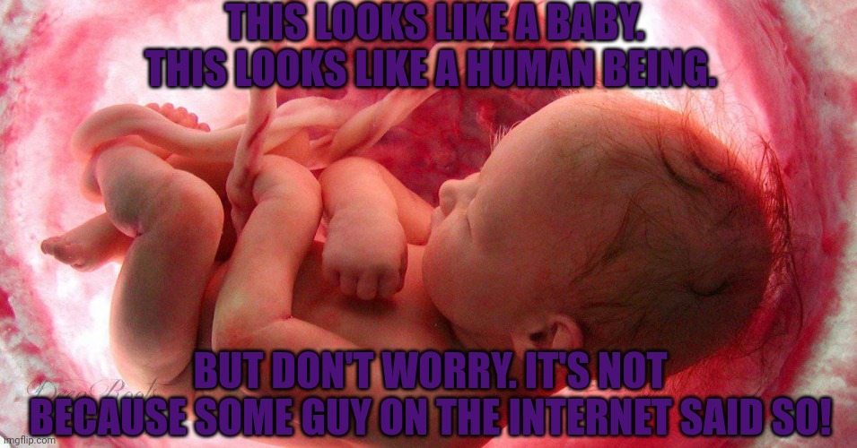 THIS LOOKS LIKE A BABY. THIS LOOKS LIKE A HUMAN BEING. BUT DON'T WORRY. IT'S NOT BECAUSE SOME GUY ON THE INTERNET SAID SO! | made w/ Imgflip meme maker