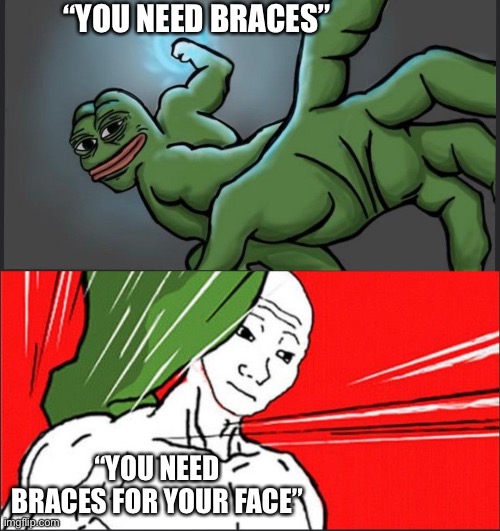 Pepe Punch Wojack Dodge | “YOU NEED BRACES”; “YOU NEED BRACES FOR YOUR FACE” | image tagged in pepe punch wojack dodge | made w/ Imgflip meme maker