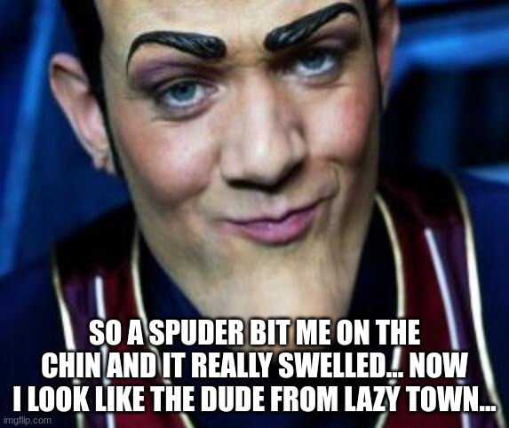 10/10 good show |  SO A SPUDER BIT ME ON THE CHIN AND IT REALLY SWELLED... NOW I LOOK LIKE THE DUDE FROM LAZY TOWN... | image tagged in lazy town | made w/ Imgflip meme maker