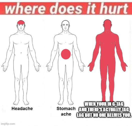 Where does it hurt | WHEN YOUR IN G-TAG AND THERE'S ACTUALLY TAG LAG BUT NO ONE BELIVES YOU. | image tagged in where does it hurt | made w/ Imgflip meme maker