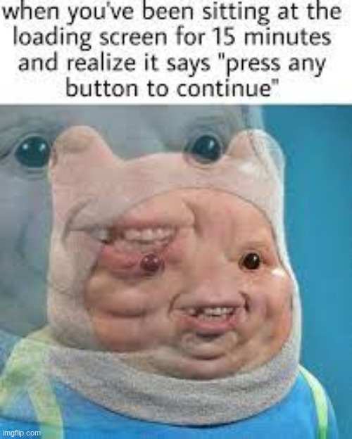 :l | image tagged in finn the human,internal screaming | made w/ Imgflip meme maker