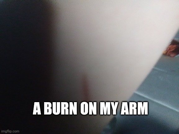 A BURN ON MY ARM | image tagged in oof | made w/ Imgflip meme maker