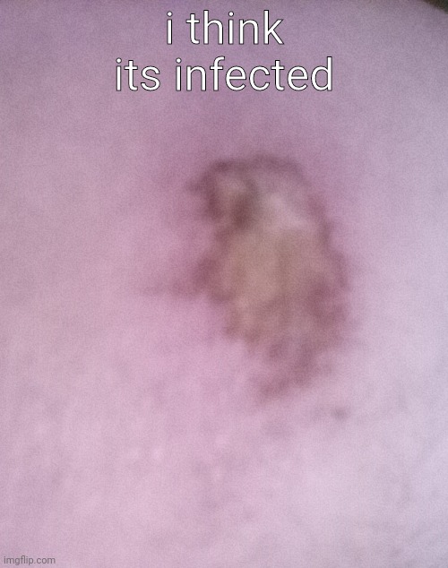 o h n o | i think its infected | made w/ Imgflip meme maker