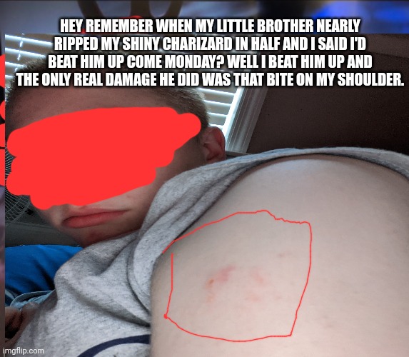 HEY REMEMBER WHEN MY LITTLE BROTHER NEARLY RIPPED MY SHINY CHARIZARD IN HALF AND I SAID I'D BEAT HIM UP COME MONDAY? WELL I BEAT HIM UP AND THE ONLY REAL DAMAGE HE DID WAS THAT BITE ON MY SHOULDER. | made w/ Imgflip meme maker