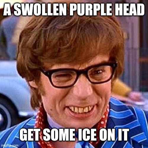 A SWOLLEN PURPLE HEAD GET SOME ICE ON IT | image tagged in austin powers wink | made w/ Imgflip meme maker