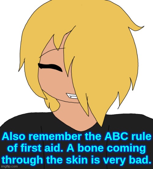Spire smiling | Also remember the ABC rule of first aid. A bone coming through the skin is very bad. | image tagged in spire smiling | made w/ Imgflip meme maker