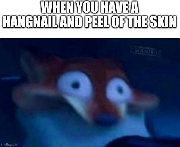 (internal screaming) | WHEN YOU HAVE A HANGNAIL AND PEEL OF THE SKIN | image tagged in nick wilde,funny,memes,funny memes | made w/ Imgflip meme maker