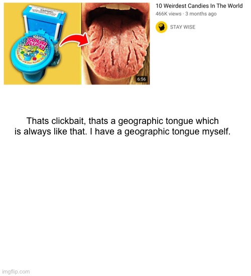 clickbait | Thats clickbait, thats a geographic tongue which is always like that. I have a geographic tongue myself. | image tagged in blank white template | made w/ Imgflip meme maker