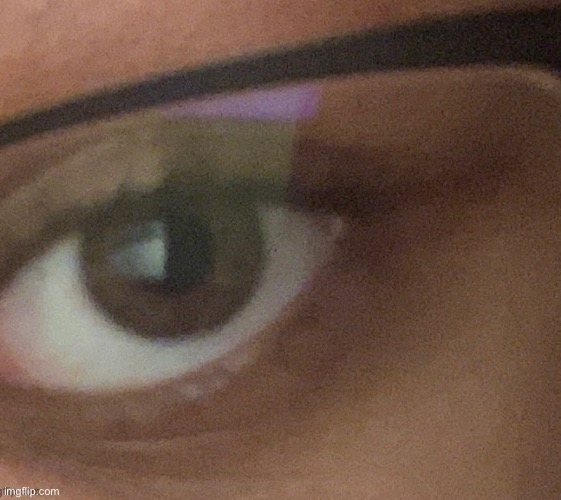 my eye again | made w/ Imgflip meme maker
