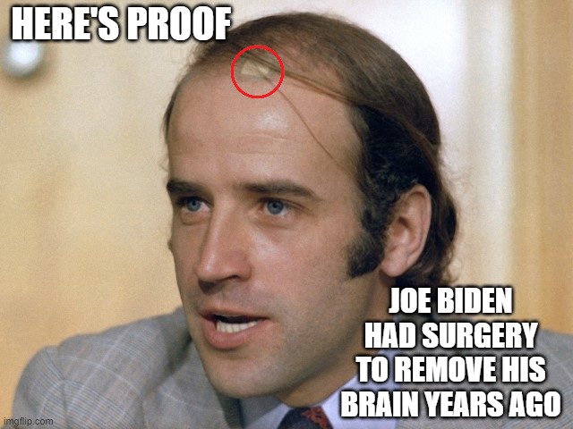 Now, this answers a LOT of questions. | HERE'S PROOF; JOE BIDEN HAD SURGERY TO REMOVE HIS BRAIN YEARS AGO | image tagged in younger joe biden,dimwit,liberals,democrats,woke,dementia | made w/ Imgflip meme maker