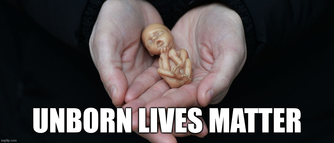 I don't use the word "abortion". Infanticide is the correct word to use. |  UNBORN LIVES MATTER | image tagged in child,murder | made w/ Imgflip meme maker