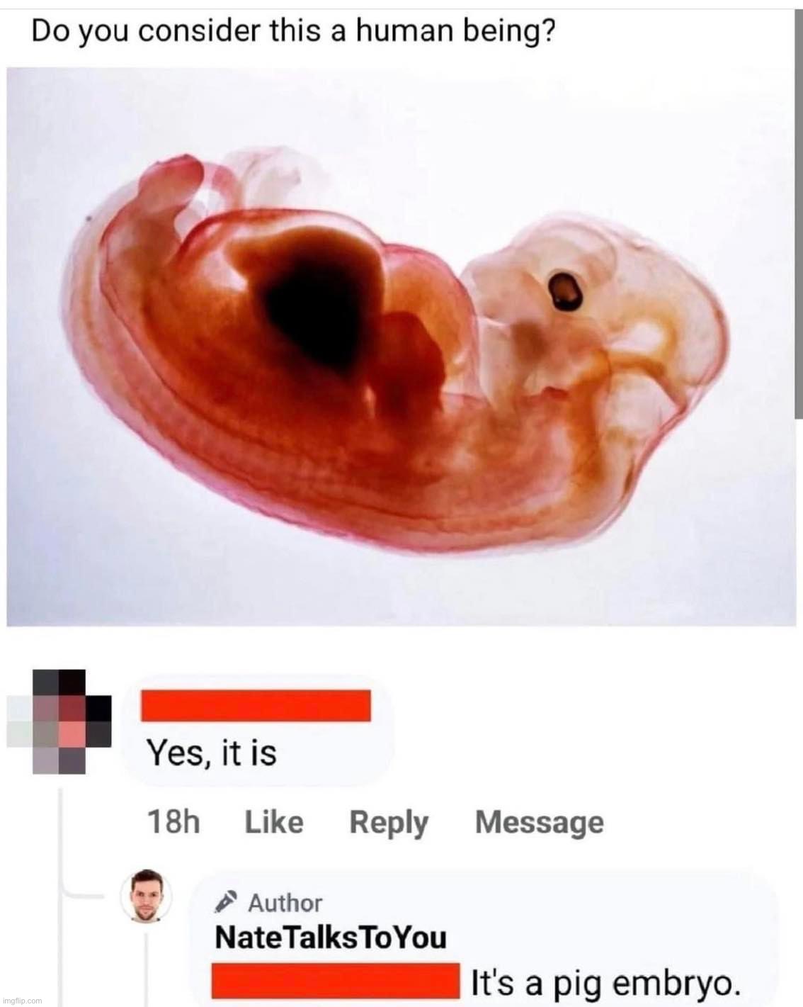 Pig embryo | image tagged in pig embryo | made w/ Imgflip meme maker