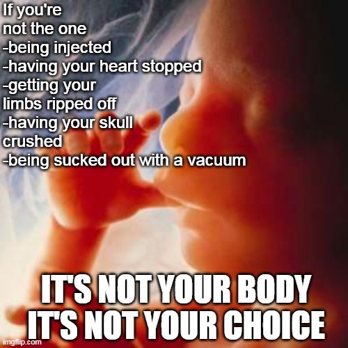 Fetus |  If you're not the one
-being injected
-having your heart stopped
-getting your limbs ripped off
-having your skull crushed
-being sucked out with a vacuum; IT'S NOT YOUR BODY
IT'S NOT YOUR CHOICE | image tagged in fetus,child,murder,abortion is murder,death,ConservativesOnly | made w/ Imgflip meme maker
