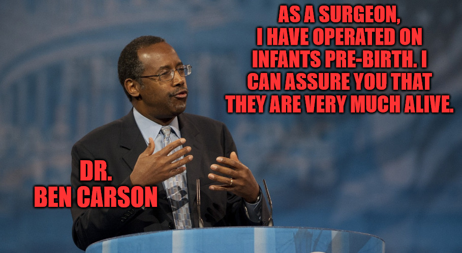Unborn isn't Unliving | AS A SURGEON, I HAVE OPERATED ON INFANTS PRE-BIRTH. I CAN ASSURE YOU THAT THEY ARE VERY MUCH ALIVE. DR. BEN CARSON | image tagged in ben carson hands | made w/ Imgflip meme maker