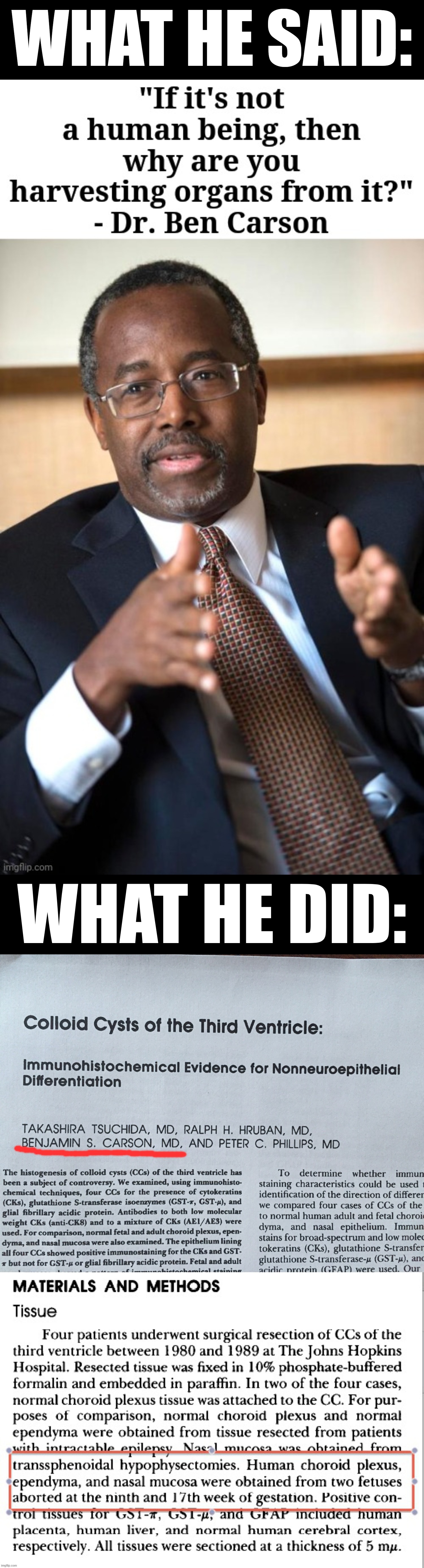 Troll of the Day: Ben Carson | WHAT HE SAID:; WHAT HE DID: | made w/ Imgflip meme maker