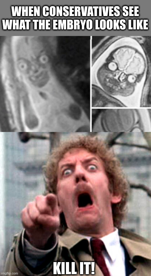 Probably | WHEN CONSERVATIVES SEE WHAT THE EMBRYO LOOKS LIKE; KILL IT! | image tagged in screaming donald sutherland | made w/ Imgflip meme maker