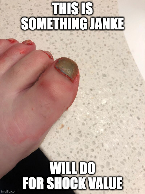 Janke Toe Fungus | THIS IS SOMETHING JANKE; WILL DO FOR SHOCK VALUE | image tagged in troll,isabella loretta janke,memes | made w/ Imgflip meme maker