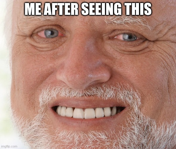 Hide the Pain Harold | ME AFTER SEEING THIS | image tagged in hide the pain harold | made w/ Imgflip meme maker