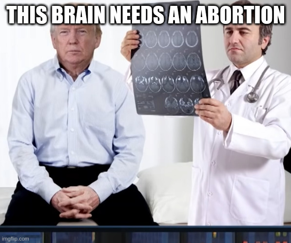 too bad not allowed anymore | THIS BRAIN NEEDS AN ABORTION | image tagged in diagnoses,rumpt,brain,abortion | made w/ Imgflip meme maker