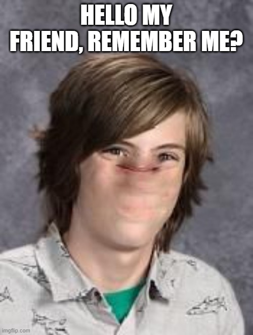 no nose boy | HELLO MY FRIEND, REMEMBER ME? | image tagged in no nose boy | made w/ Imgflip meme maker