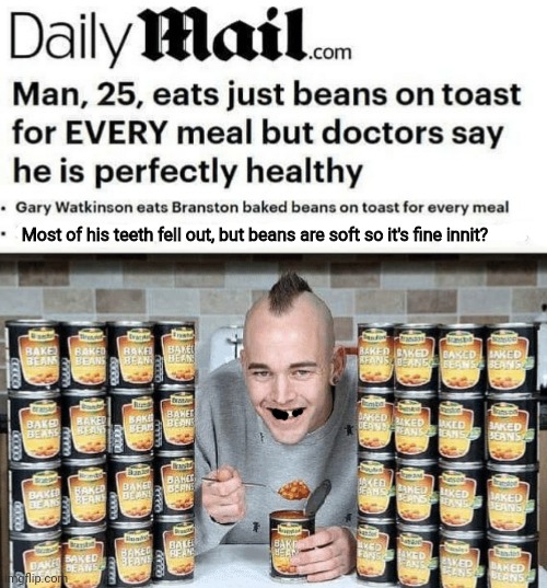 British man eats almost as many beans as Envoy. | Most of his teeth fell out, but beans are soft so it's fine innit? | image tagged in but why tho,british,problems,bean,shortage | made w/ Imgflip meme maker