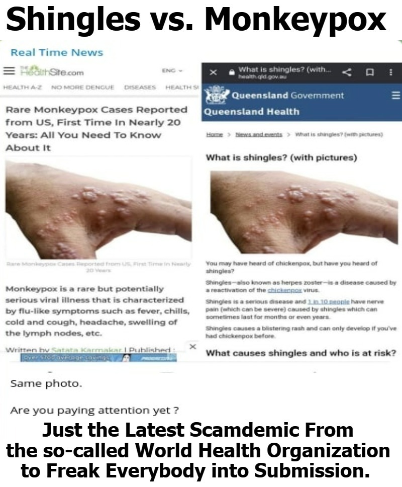 Shingles vs. Monkeypox | image tagged in shingles,monkeypox,scamdemic,plandemic,covidiots,monkey business | made w/ Imgflip meme maker