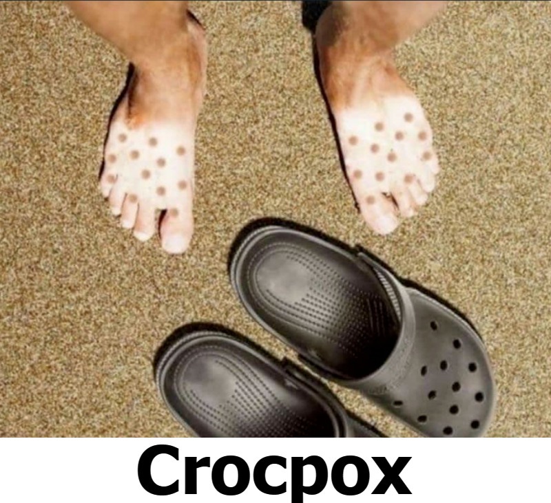 Freaking News: The New Trending Disease is Called Crocpox! | image tagged in freaking out,freaking news,trending now,trendy diseases,crocpox,covidiots | made w/ Imgflip meme maker