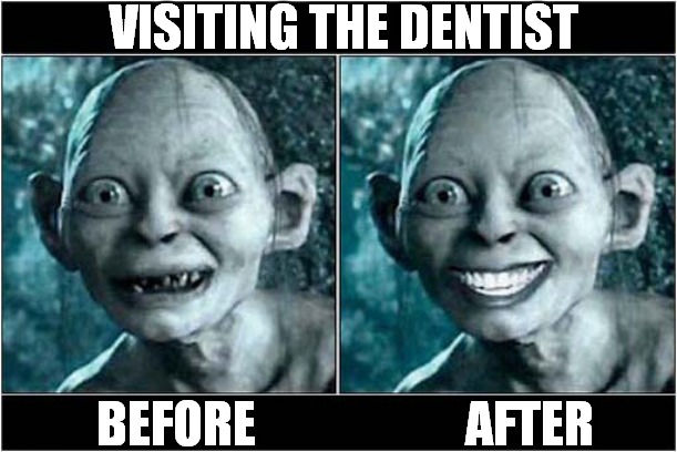 Smile ! | VISITING THE DENTIST; BEFORE                     AFTER | image tagged in gollum,dentist,smile | made w/ Imgflip meme maker