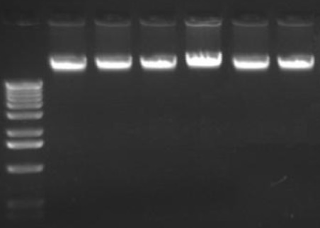 genomic dna gel electrophoresis Blank Meme Template