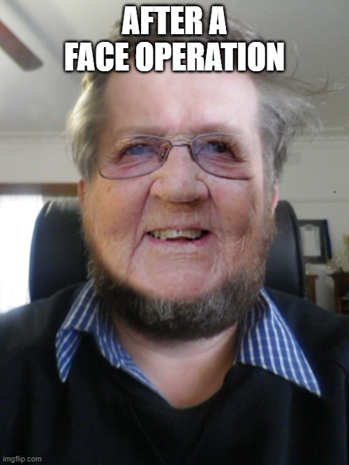 Andrew | AFTER A FACE OPERATION | image tagged in andrew | made w/ Imgflip meme maker